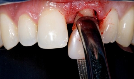 بهترین دندانپزشک برای جراحی دندان