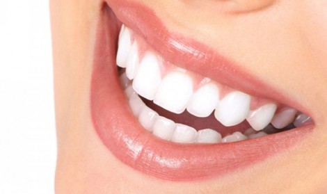 زیبایی دندان با لمینت سرامیکی 